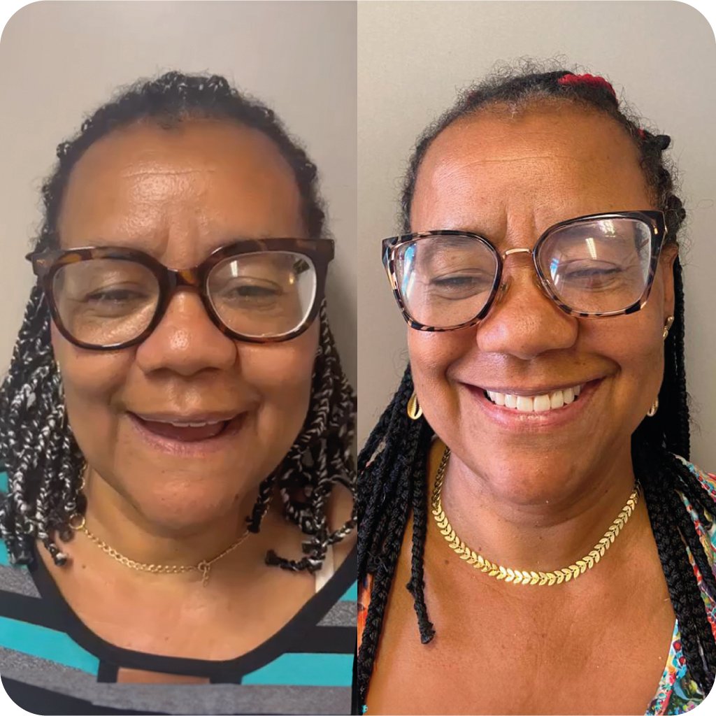 Implante e Protocolo Dental